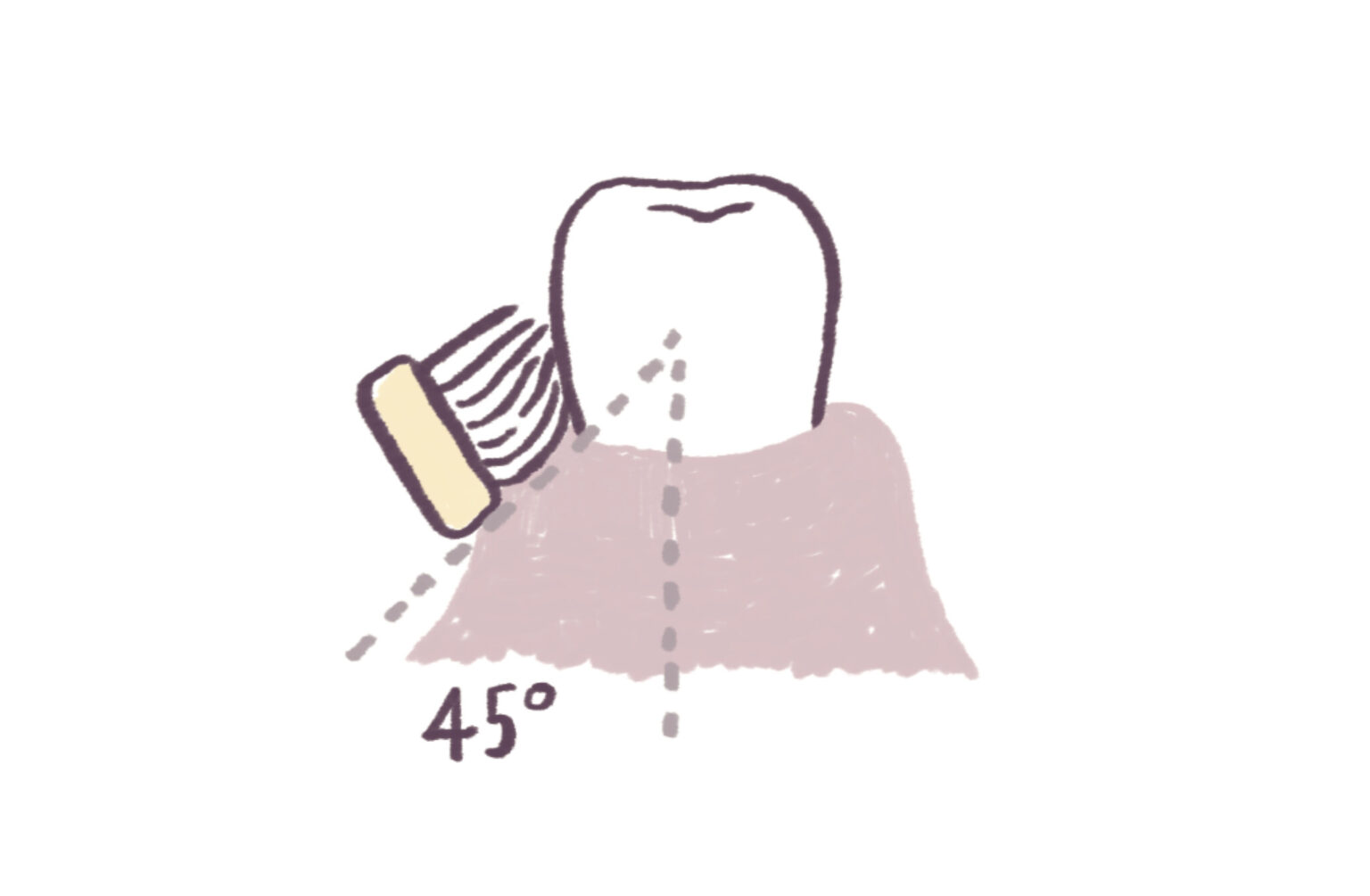 4.歯茎マッサージ「チャーターズ法」。上向きの約45度で歯に当てて回転させるように磨く。歯茎のマッサージ効果があるほか、歯ブラシの毛先が歯間に入りやすく、汚れをかき出すことができる。
