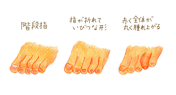 【足占い】薬指が好きな人は恋愛力が高い!? 薬指から変容力と人間関係を分析 | Hanako Web