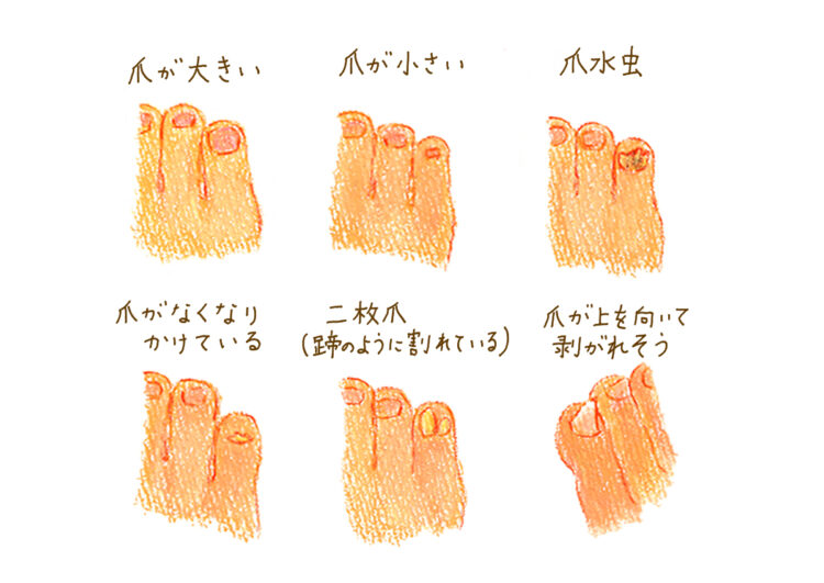 【足占い】あなたは幸運体質? 小指の状態からわかる金運、自己信頼感 | Hanako Web